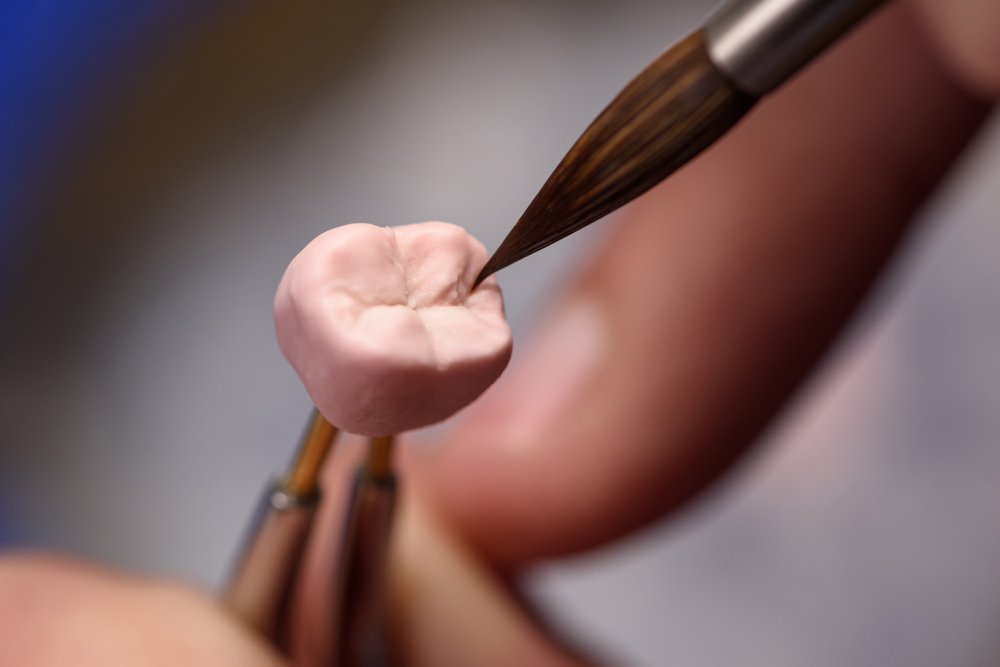 fake tooth creation - dental crowns